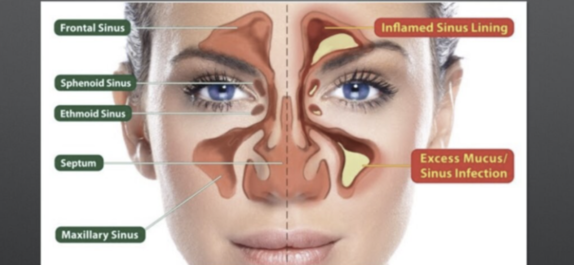 SINUS PROTOCOL